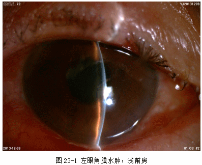 ZY016_119_1.gif